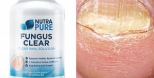 NutraPure Clear Fungus Review